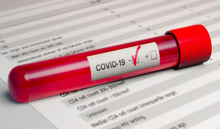 MAI – bilanț COVID-19. Câte cazuri noi au fost raportate- 22 iunie 2020. Vine al doilea val de infecţii?